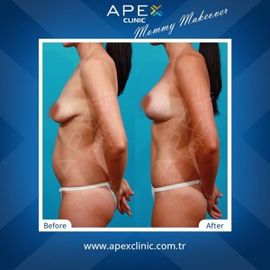 Image of Apex Clinic Istanbul Gallery 0