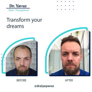 Image of Doctor Ziya Yavuz Hair Transplant Clinic Gallery 1