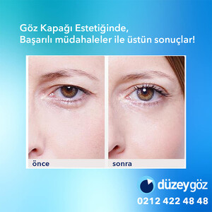 Image of Düzey Eye Center Gallery 1