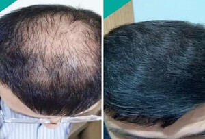 Image of Lale Hair Transplant Clinic Gallery 1