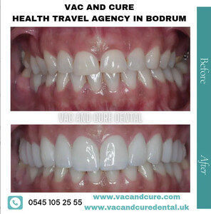 Image of Vac and Cure Health and Aesthetics Bodrum Gallery 2