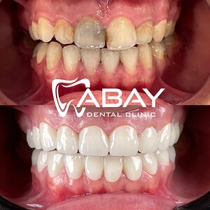 Image of Abay Dental Centre Gallery 0