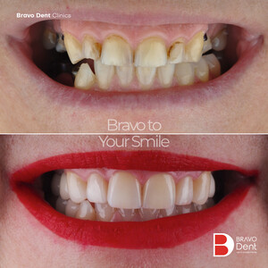 Image of Smile makeover