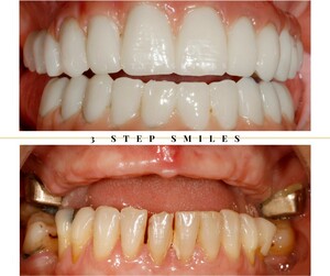 Image of 3StepSmiles Dental Clinic Liverpool Gallery 1