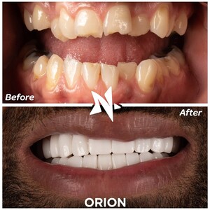 Image of Orion Dental Health Gallery 3