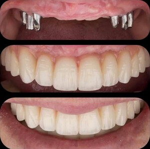 Image of Atk Dentpark Clinic Antalya Gallery 0