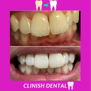 Image of Clinish Dental Gallery 1