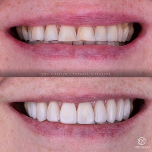 Image of Smile design