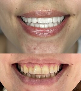 Image of Dental Care Before and After