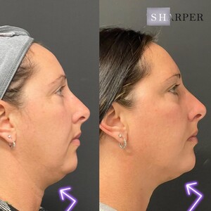 Image of SHarper Plastic & Reconstructive Surgery Gallery 3