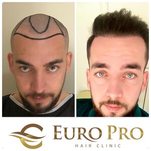 Image of EURO PRO HAIR Clinic Gallery 2