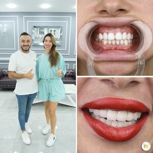 Image of Yesilyurt Dental Gallery 0