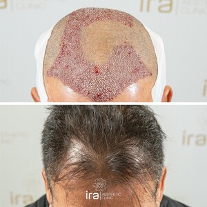 Image of Ira Aesthetic Clinic Gallery 0