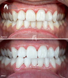 Image of All On Dental Clinic Istanbul Gallery 1