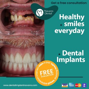 Image of Dental implants and smile makeover