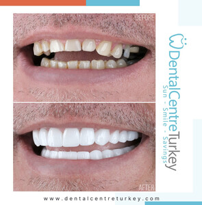 Image of Dental Centre Turkey Gallery 0