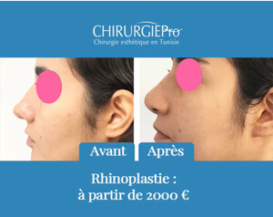 Image of ChirurgiePro - Chirurgie esthétique en Tunisie Gallery 1