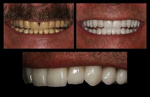 Image of Best Dental Smile Studio Gallery 3