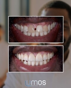 Image of Lumos  Dental Clinic Gallery 3