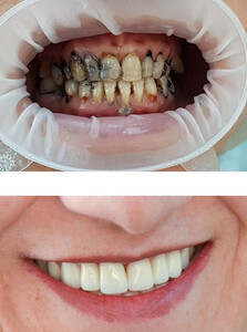 Image of New Smile Antalya Dental Clinic Gallery 1