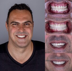 Image of Smile makeover