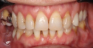 Image of Avenue Dental Caloundra Gallery 3