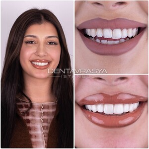 Image of Dentavrasya Dental Clinic Istanbul Turkey Gallery 0