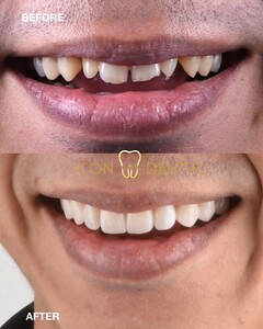 Image of Smile makeover