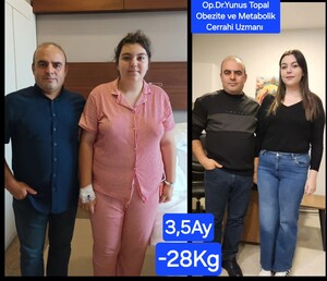 Image of Weight loss surgery before and after