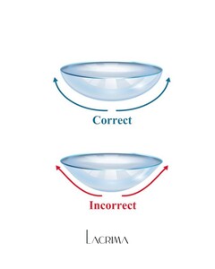 Image of Lenses - Lacrima Polyclinic