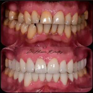 Image of DentSmile Gallery 0