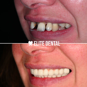 Image of Dentista Albania - Elite Dental Gallery 3