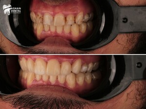 Image of Asnan Dental Center Gallery 3