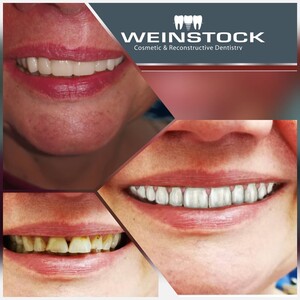 Image of Weinstock Cosmetic & Reconstructive Dentistry Gallery 3