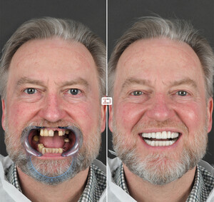 Image of Emergency Dentist - Vale Dental Gallery 3