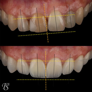 Image of Before and After Image