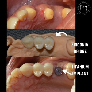 Image of Dental treatment