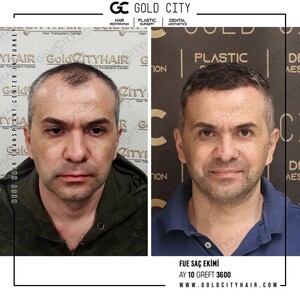 Image of Gold City Hair Gallery 2