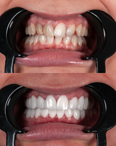 Image of DentArma Turkey Dental Clinic Gallery 0