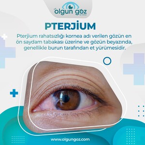 Image of Olgun Eye Medical Center Gallery 0