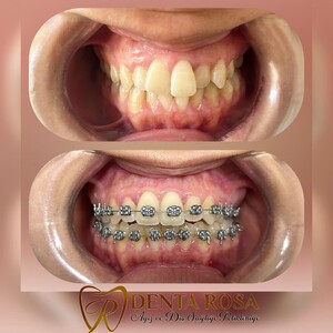 Image of Denta Rosa Oral and Dental Health Polyclinic Gallery 3