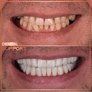 Image of Dental Support Turkey Gallery 3