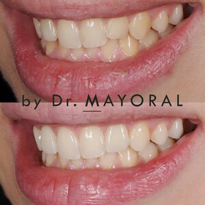 Image of Barcelona Smile Center by Dr. Mayoral Gallery 1