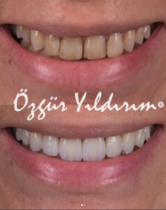 Image of Özgür Yıldırım Aesthetic Dental Clinic Gallery 1