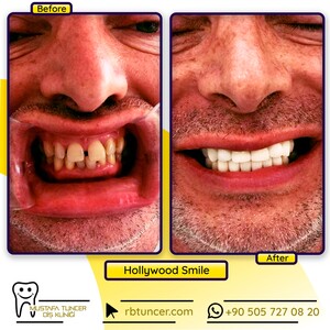 Image of Mustafa Tuncer Dental Clinic Gallery 2