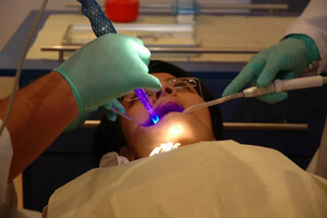 Image of Teeth whitening - Dr. Ayman Nassef 