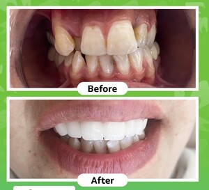 Image of Smile makeover