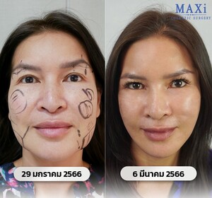 Image of MAXi Cosmetic Surgery Gallery 0