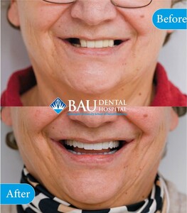 Image of Smile makeover