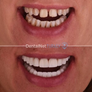 Image of Dental Net Turkey Gallery 2